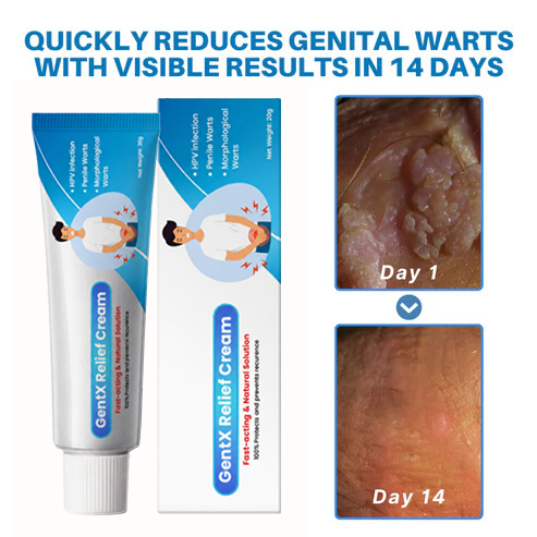 Vexyno HPV Wart Cream Main Banner